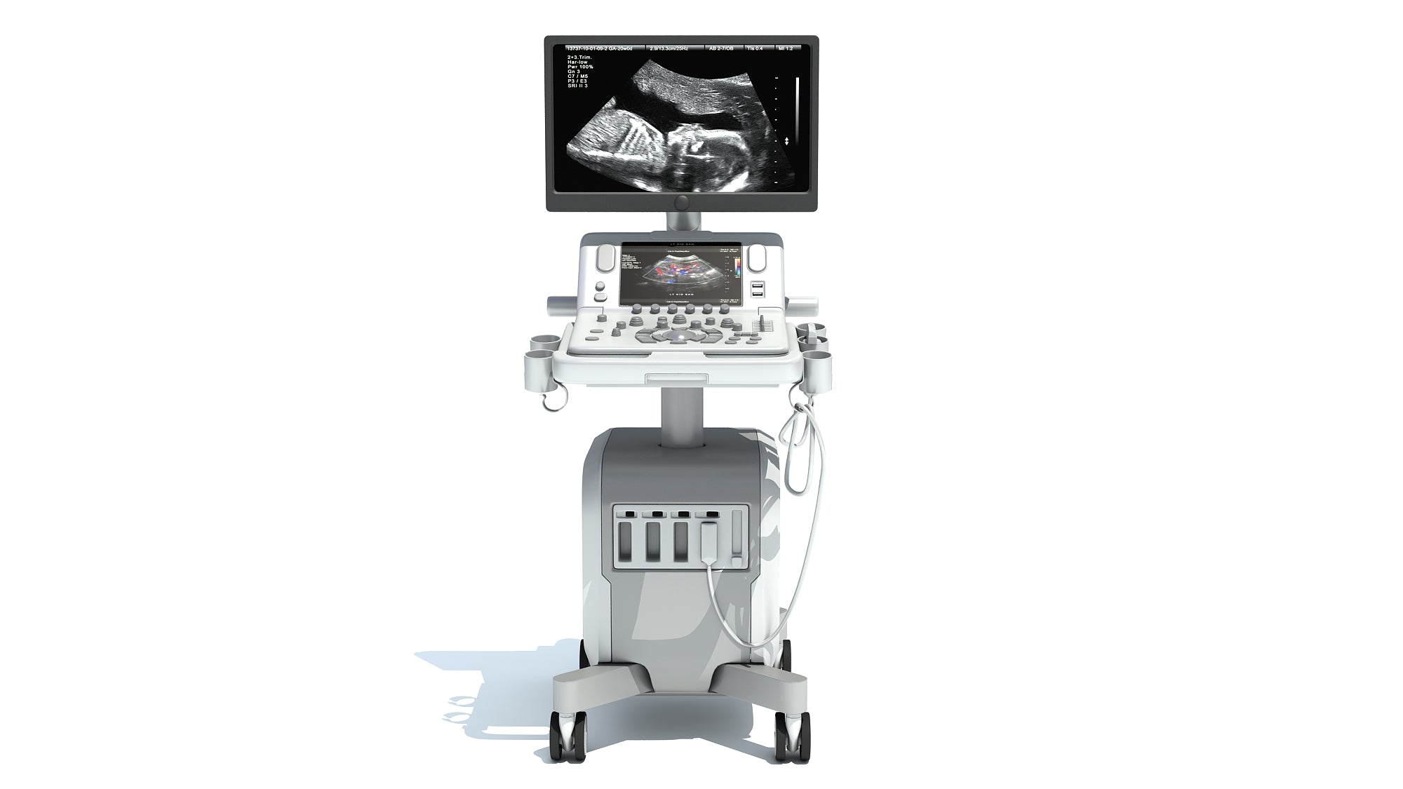 On Platform Ultrasound System