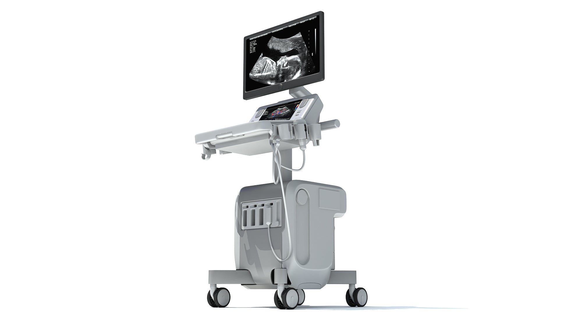 On Platform Ultrasound System