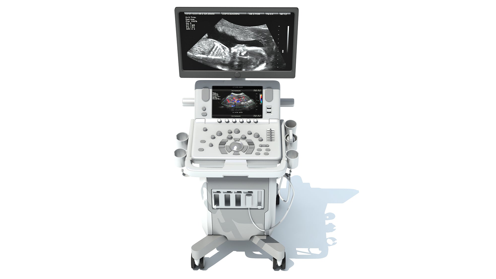 On Platform Ultrasound System