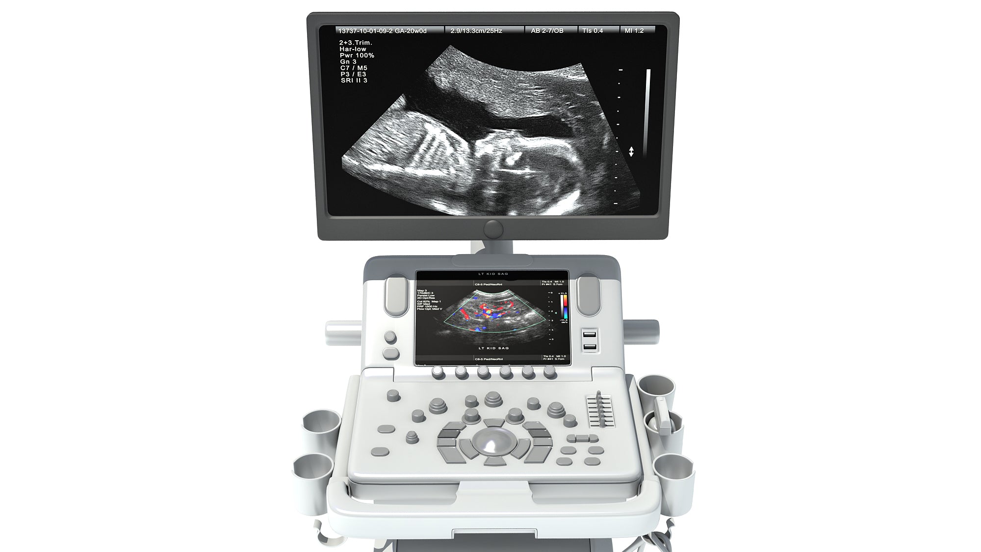 On Platform Ultrasound System