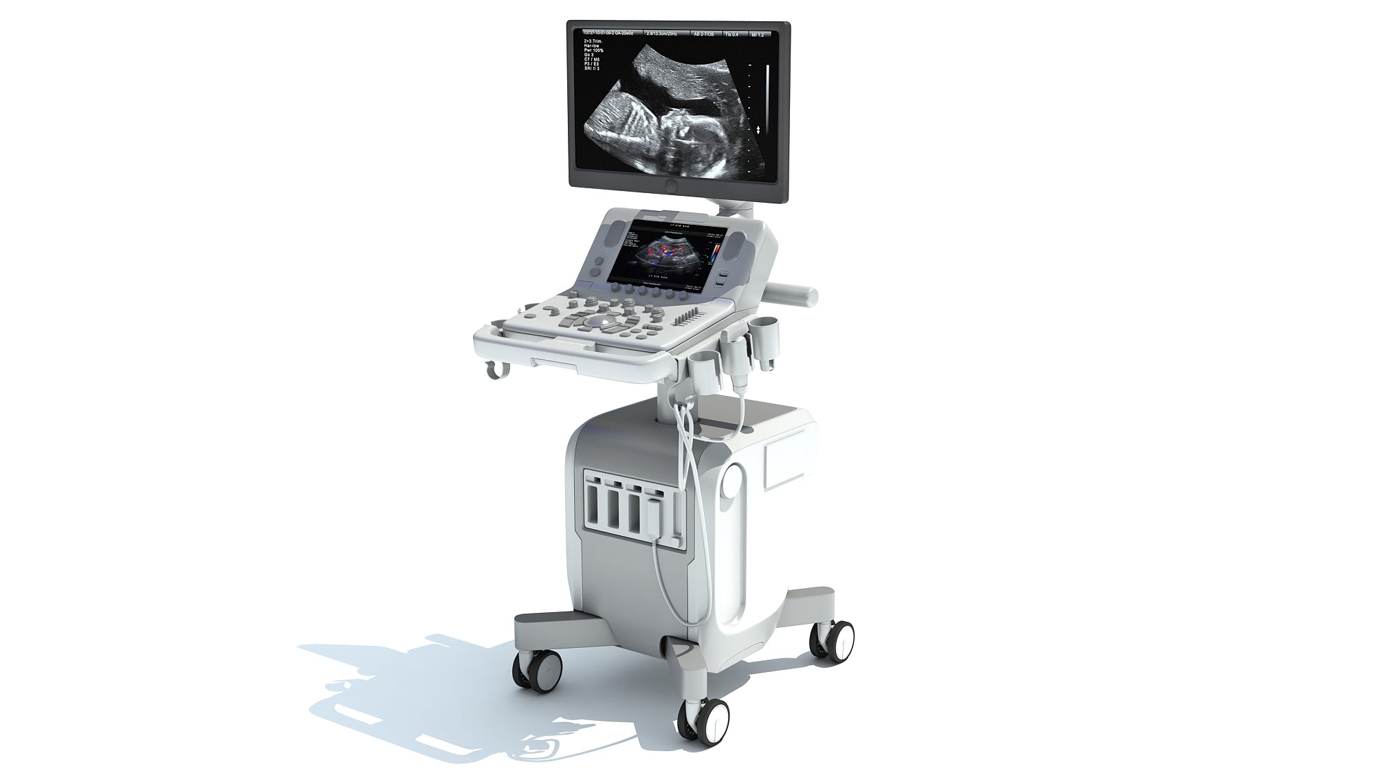 On Platform Ultrasound System