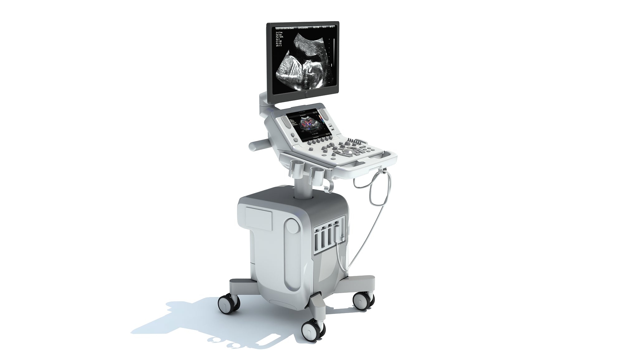 On Platform Ultrasound System